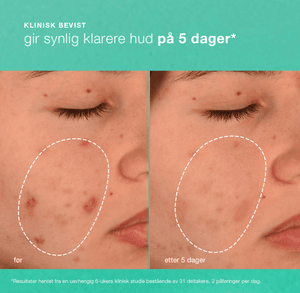 Hovedbilde breakout biotic moisturizer