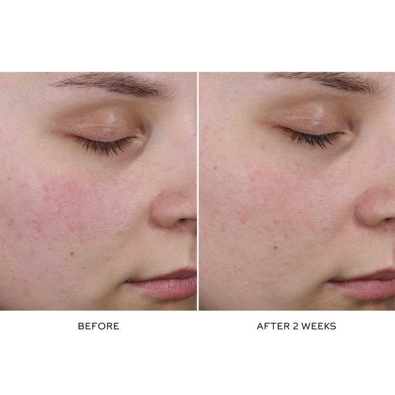 Pore Refining Complex Serum