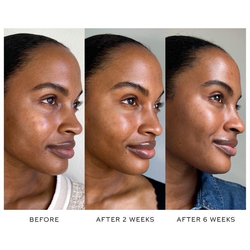 Suprême C Serum