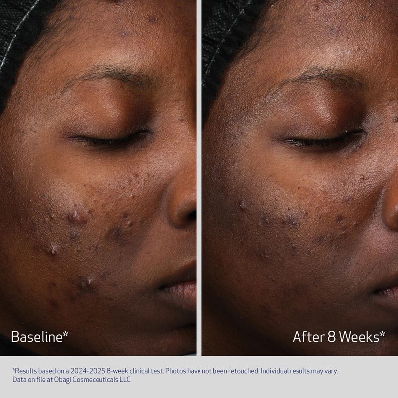 RETINOL + PHA