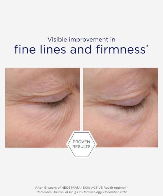 Hovedbilde Intensive Eye Therapy