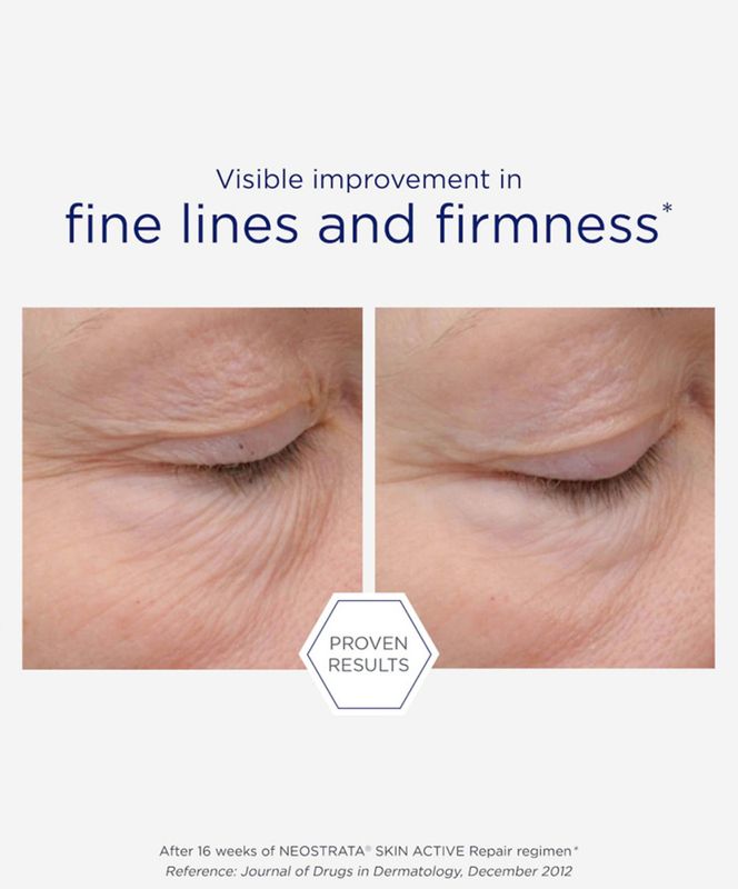 Intensive Eye Therapy